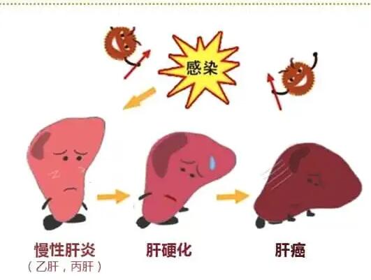 三级片香蕉视频廠家提醒肝髒疾病治不好？要了解是否含鐵食物攝入多